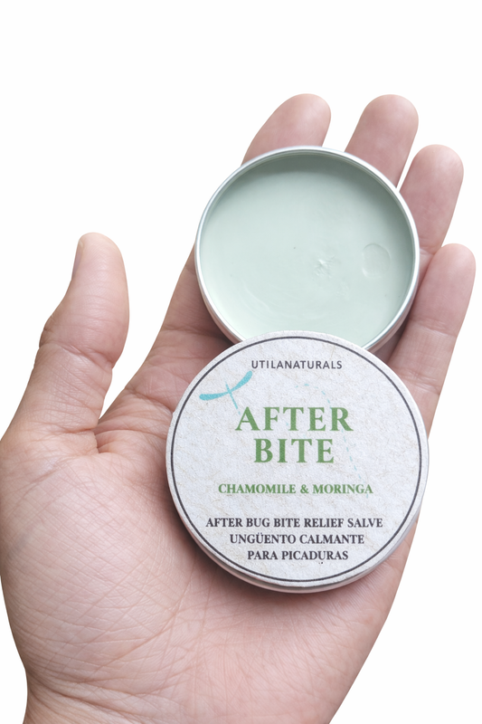 After Bite – Soothing Herbal Relief